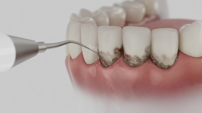 Reliable Dental Implants contractor in Cedarville, AR by Smile Center Dentistry